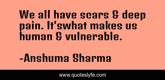 We all have scars & deep pain. It'swhat makes us human & vulnerable.