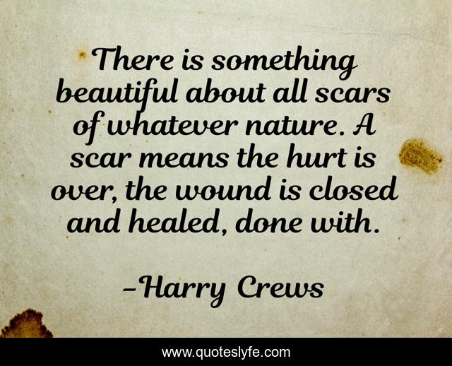 There is something beautiful about all scars of whatever nature. A scar means the hurt is over, the wound is closed and healed, done with.