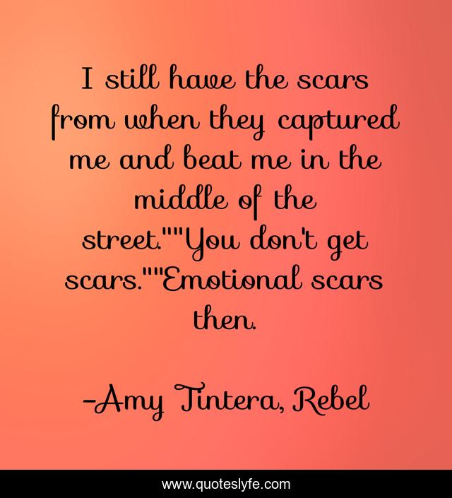 I still have the scars from when they captured me and beat me in the middle of the street.