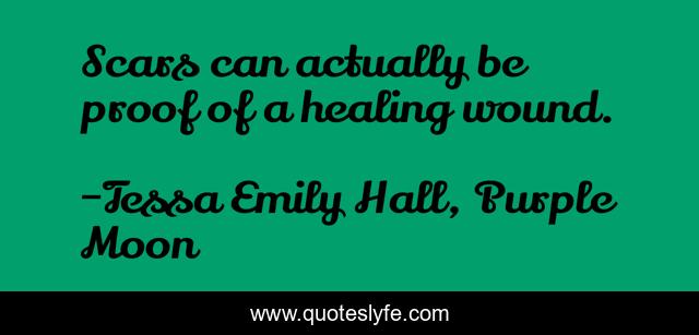 Scars can actually be proof of a healing wound.