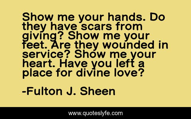 Show Me Your Hands Do They Have Scars From Giving Show Me Your Feet Quote By Fulton J Sheen Quoteslyfe