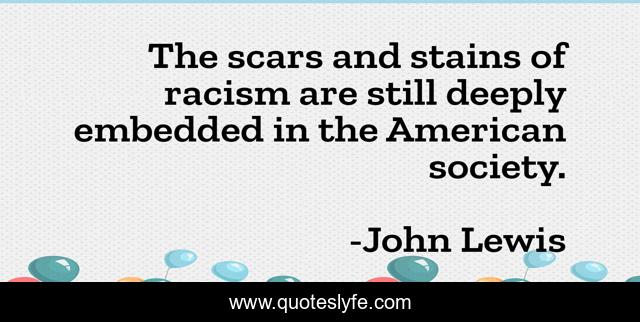 The scars and stains of racism are still deeply embedded in the American society.