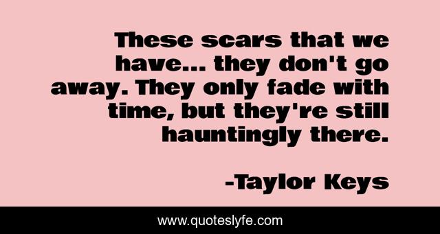 These scars that we have... they don't go away. They only fade with time, but they're still hauntingly there.