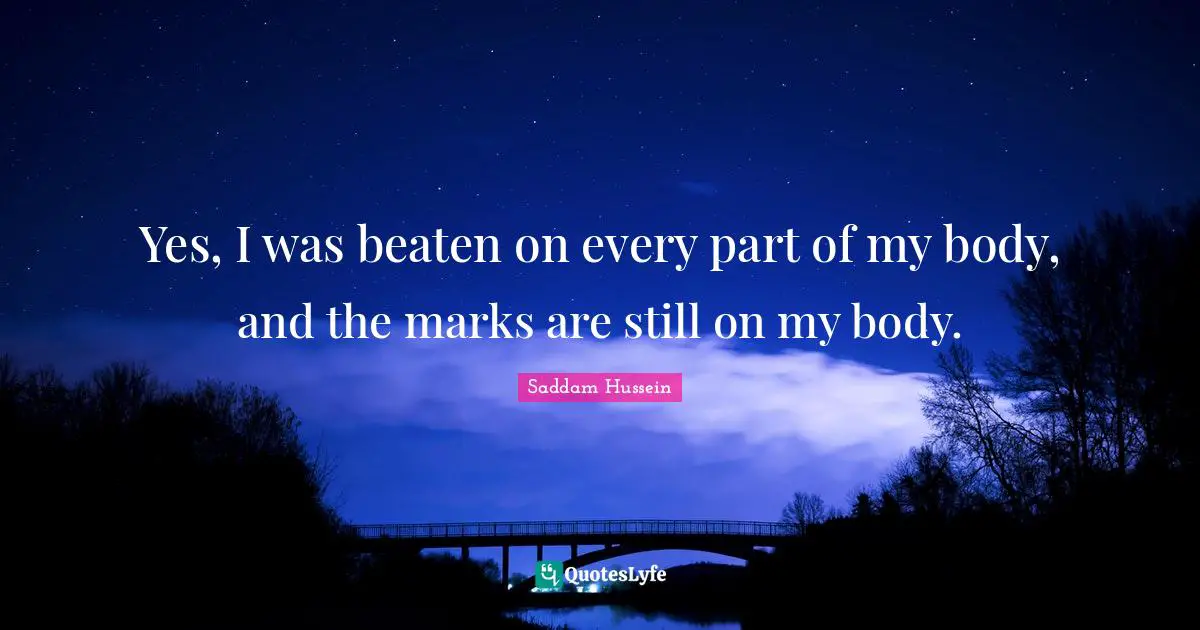 Saddam Hussein Quotes: Yes, I was beaten on every part of my body, and the marks are still on my body.