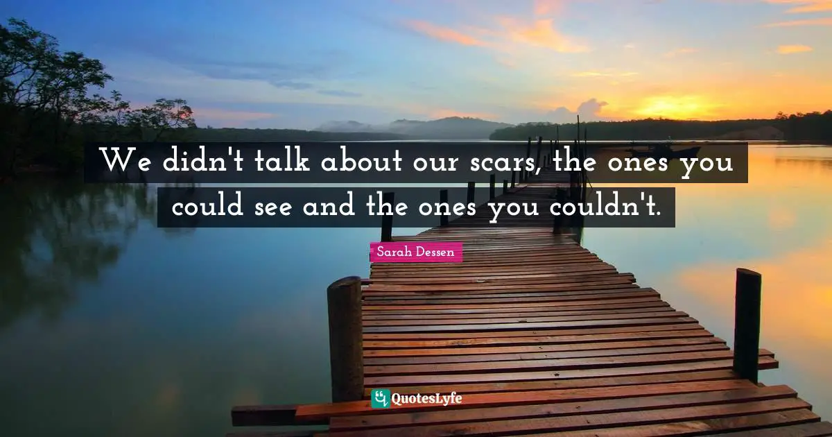 We didn't talk about our scars, the ones you could see and the ones you couldn't.