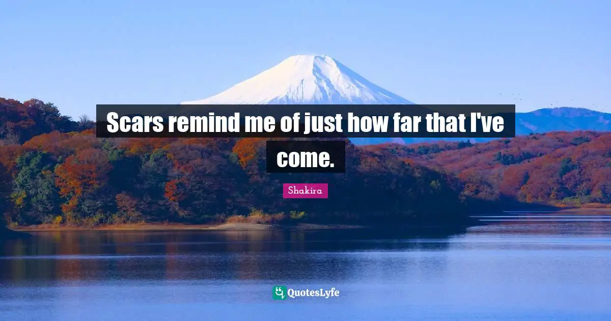 Scars remind me of just how far that I've come.