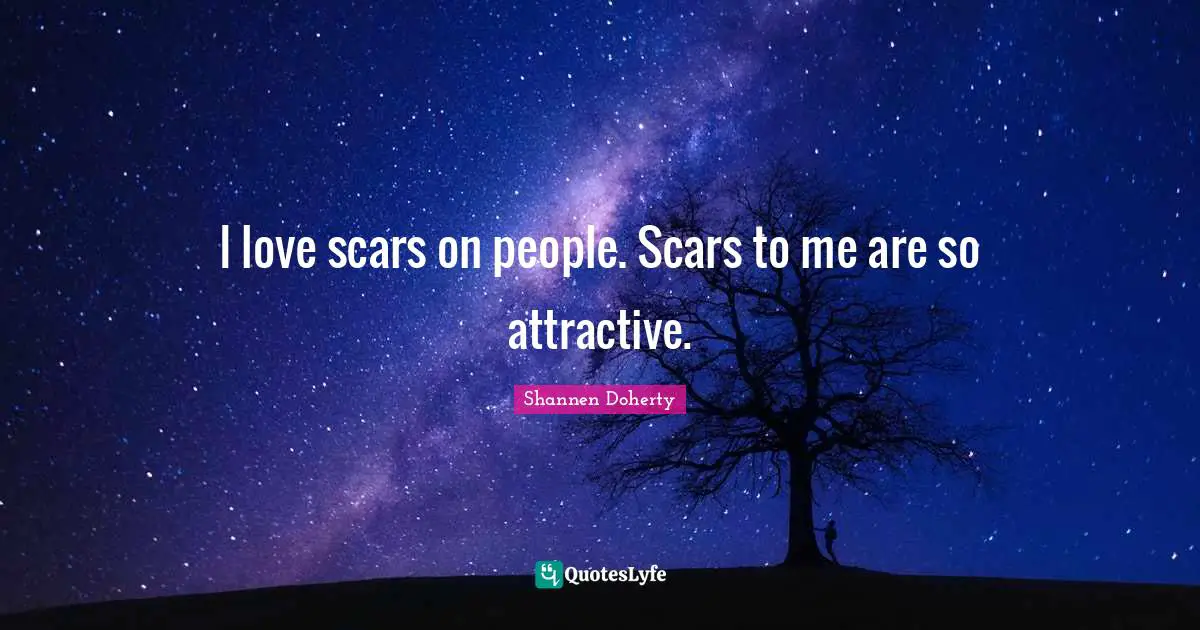 Shannen Doherty Quotes: "I love scars on people. Scars to me are so attractive."