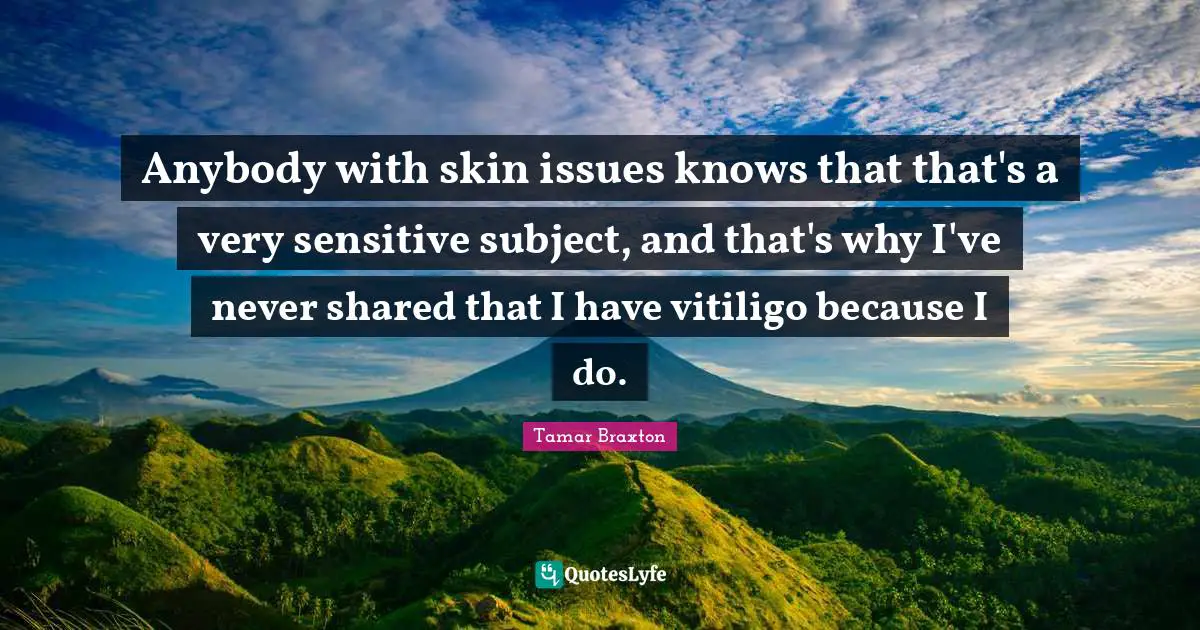 Anybody with skin issues knows that that's a very sensitive subject, and that's why I've never shared that I have vitiligo because I do.