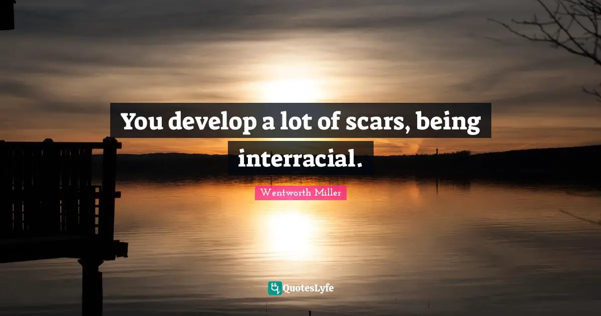 You develop a lot of scars, being interracial.