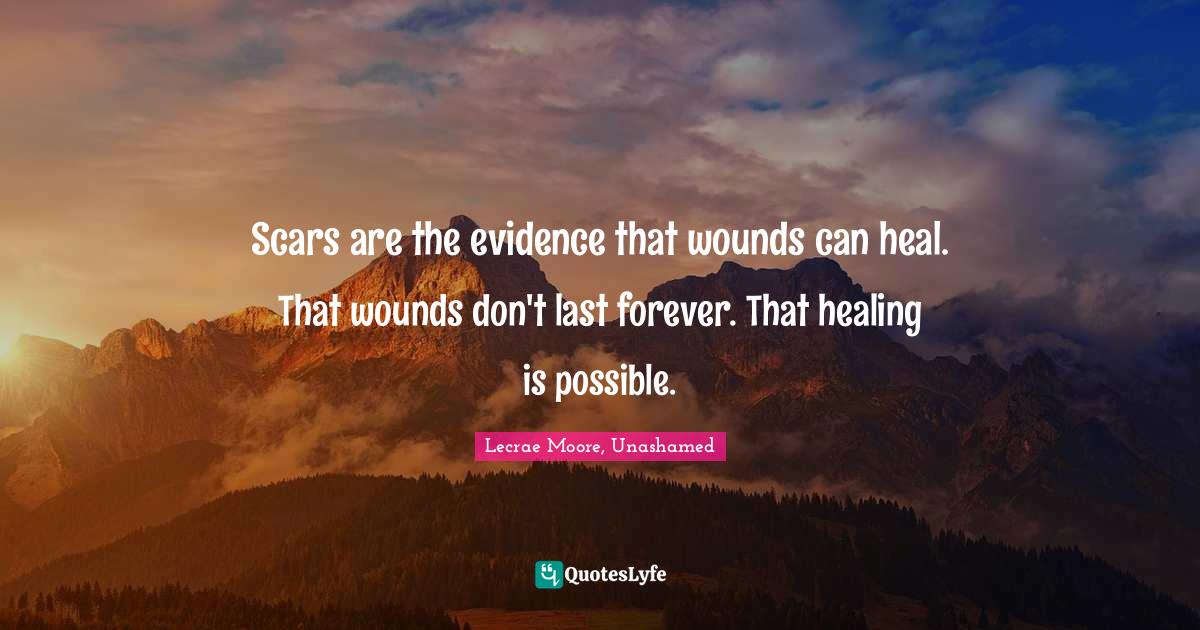 Scars are the evidence that wounds can heal. That wounds don't last fo