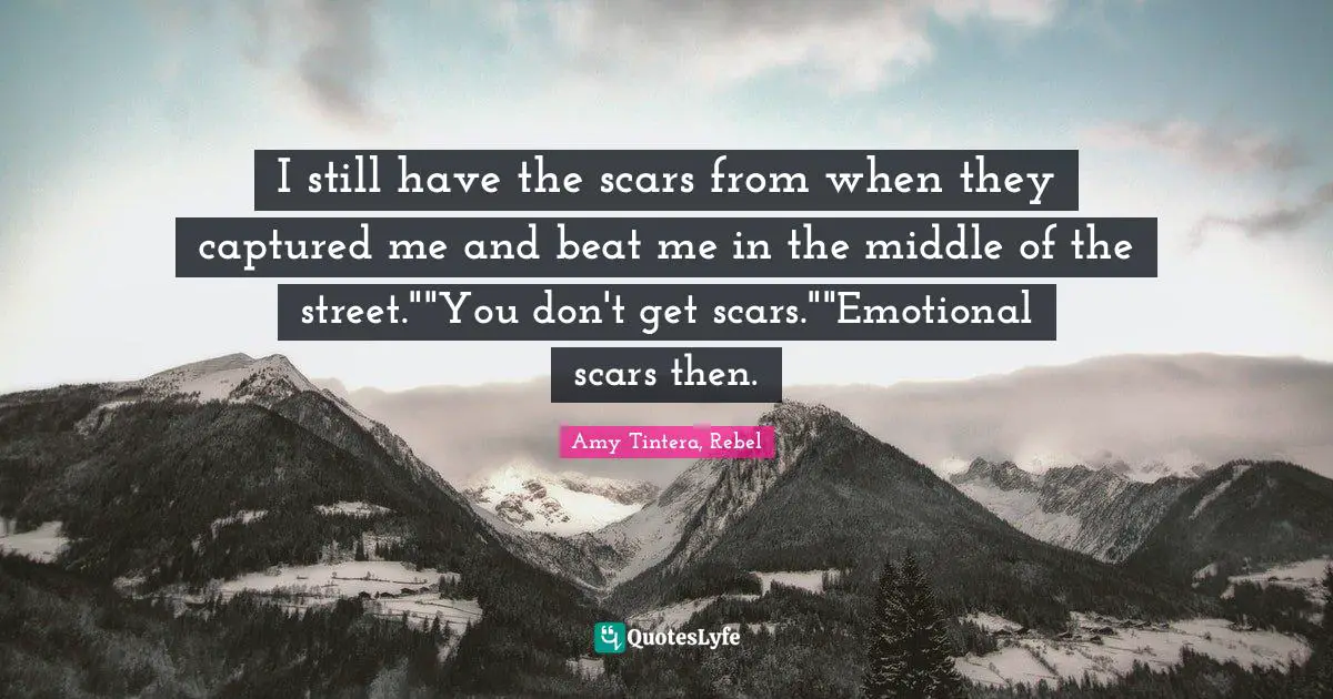 I still have the scars from when they captured me and beat me in the middle of the street.""You don't get scars.""Emotional scars then.