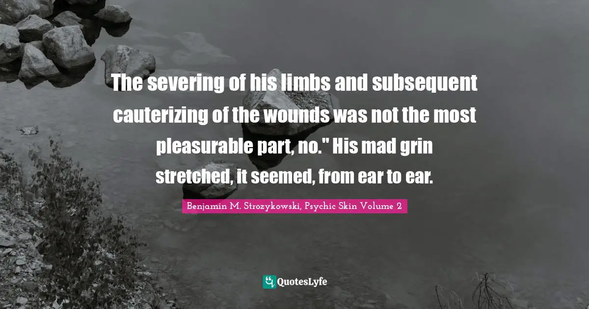 The severing of his limbs and subsequent cauterizing of the wounds was not the most pleasurable part, no." His mad grin stretched, it seemed, from ear to ear.