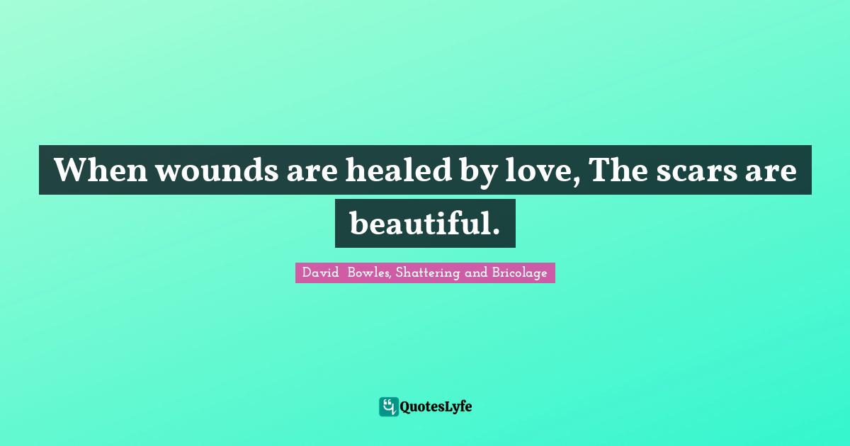 When wounds are healed by love, The scars are beautiful.