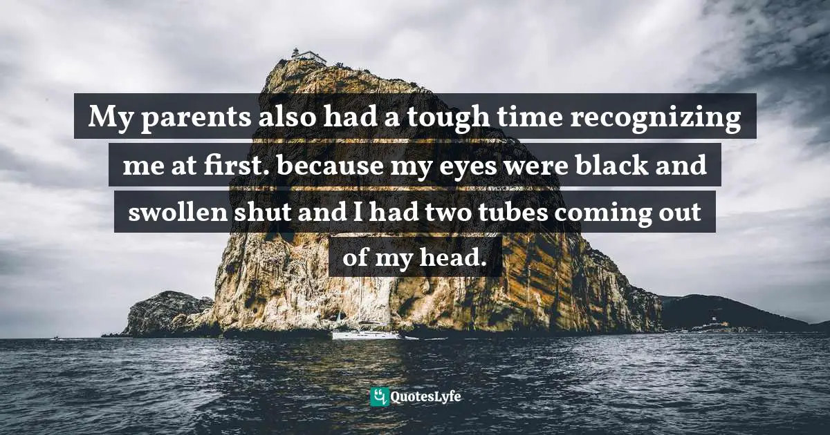 My parents also had a tough time recognizing me at first. because my eyes were black and swollen shut and I had two tubes coming out of my head.