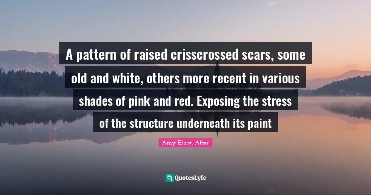 A pattern of raised crisscrossed scars, some old and white, others more recent in various shades of pink and red. Exposing the stress of the structure underneath its paint
