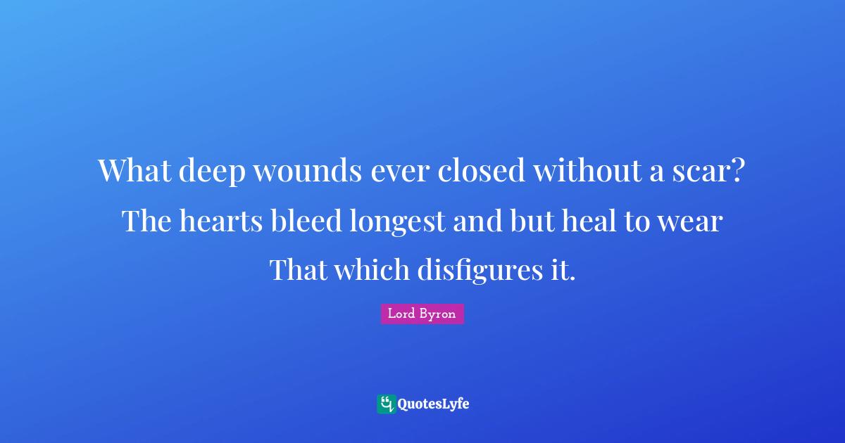 What deep wounds ever closed without a scar? The hearts bleed longest and but heal to wear That which disfigures it.