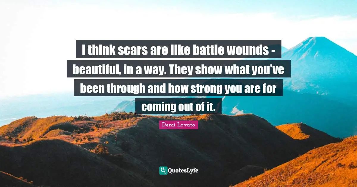 I think scars are like battle wounds - beautiful, in a way. They show what you've been through and how strong you are for coming out of it.