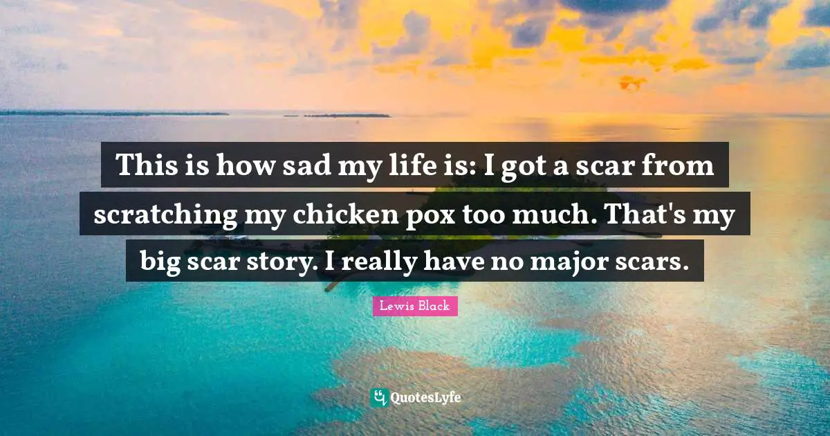 This is how sad my life is: I got a scar from scratching my chicken pox too much. That's my big scar story. I really have no major scars.