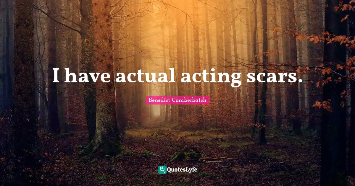 I have actual acting scars.