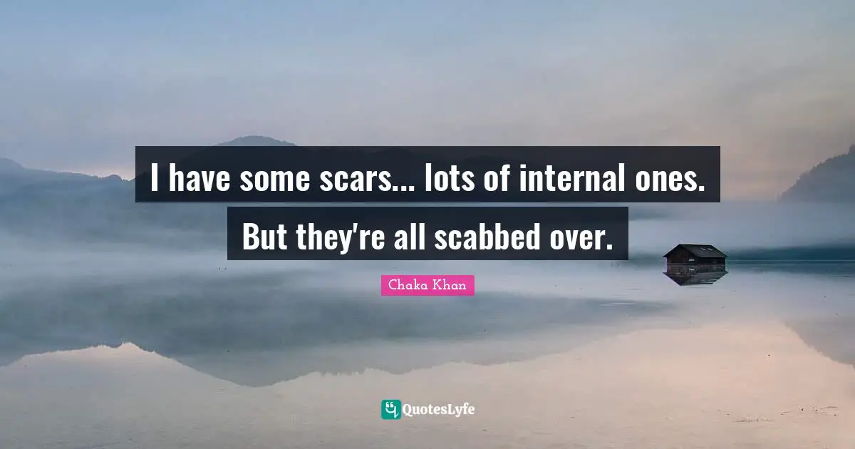 I have some scars... lots of internal ones. But they're all scabbed over.