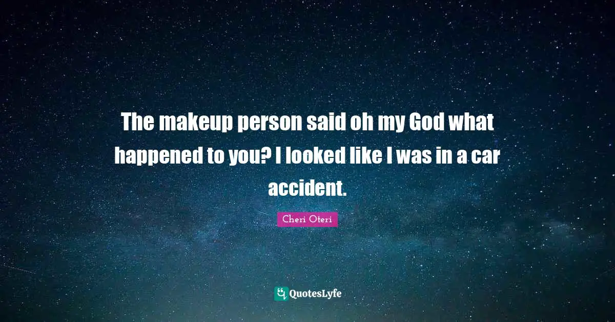 The makeup person said oh my God what happened to you? I looked like I was in a car accident.