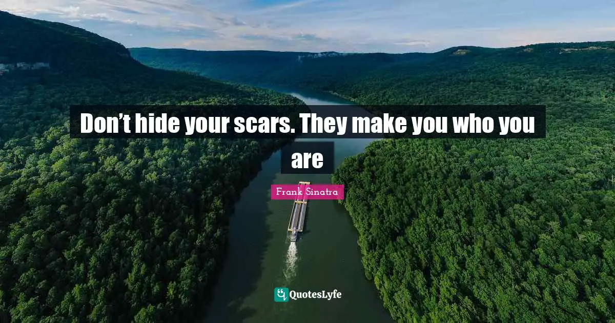 Don’t hide your scars. They make you who you are