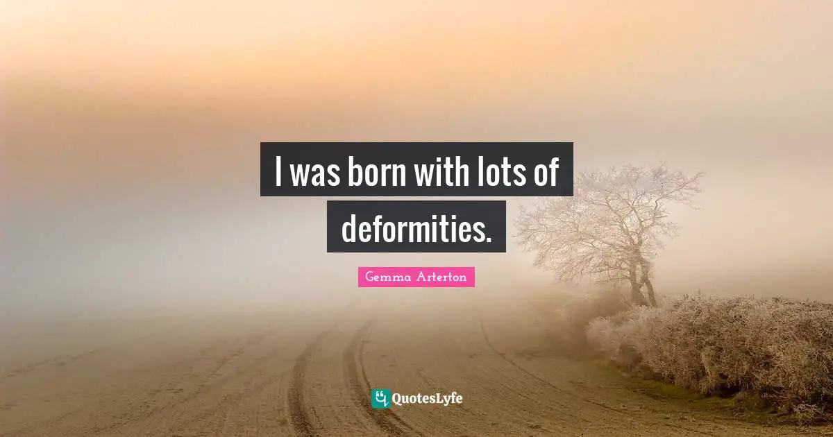 I was born with lots of deformities.