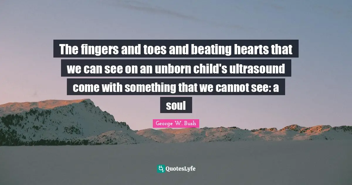 The fingers and toes and beating hearts that we can see on an unborn child's ultrasound come with something that we cannot see: a soul