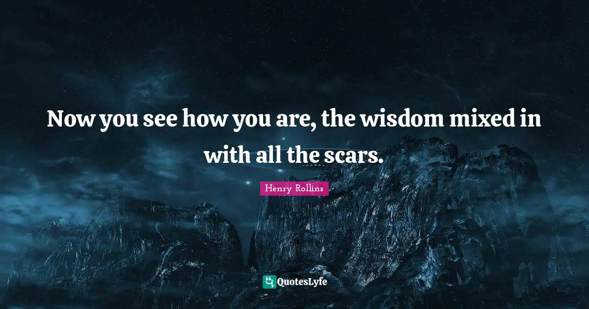 Now you see how you are, the wisdom mixed in with all the scars.