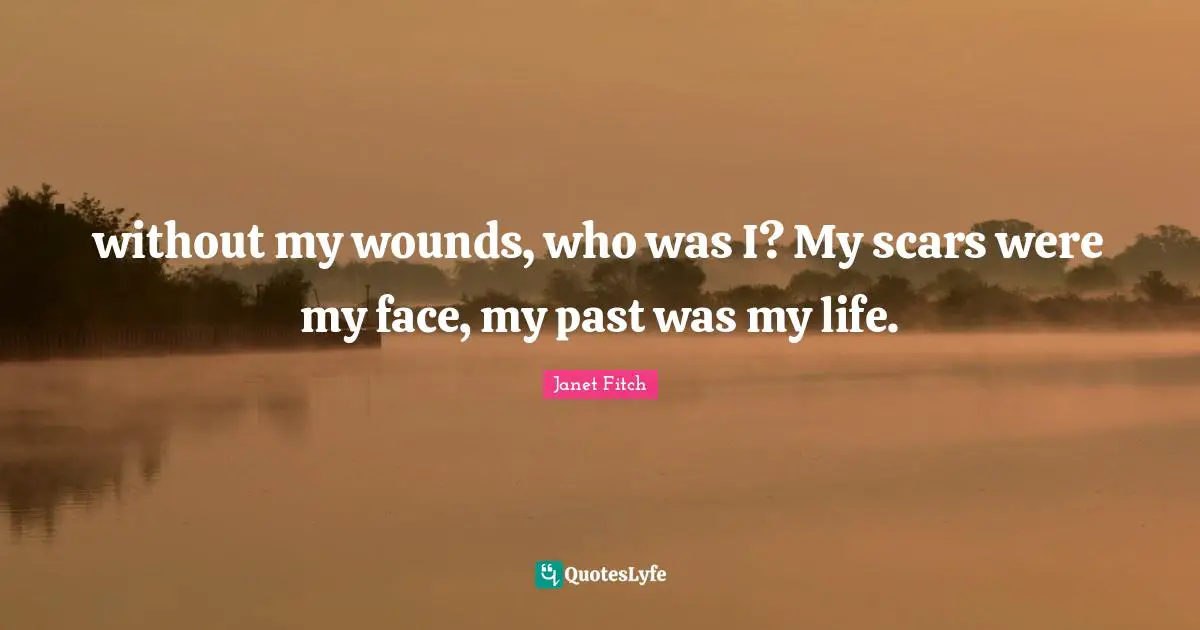 without my wounds, who was I? My scars were my face, my past was my life.
