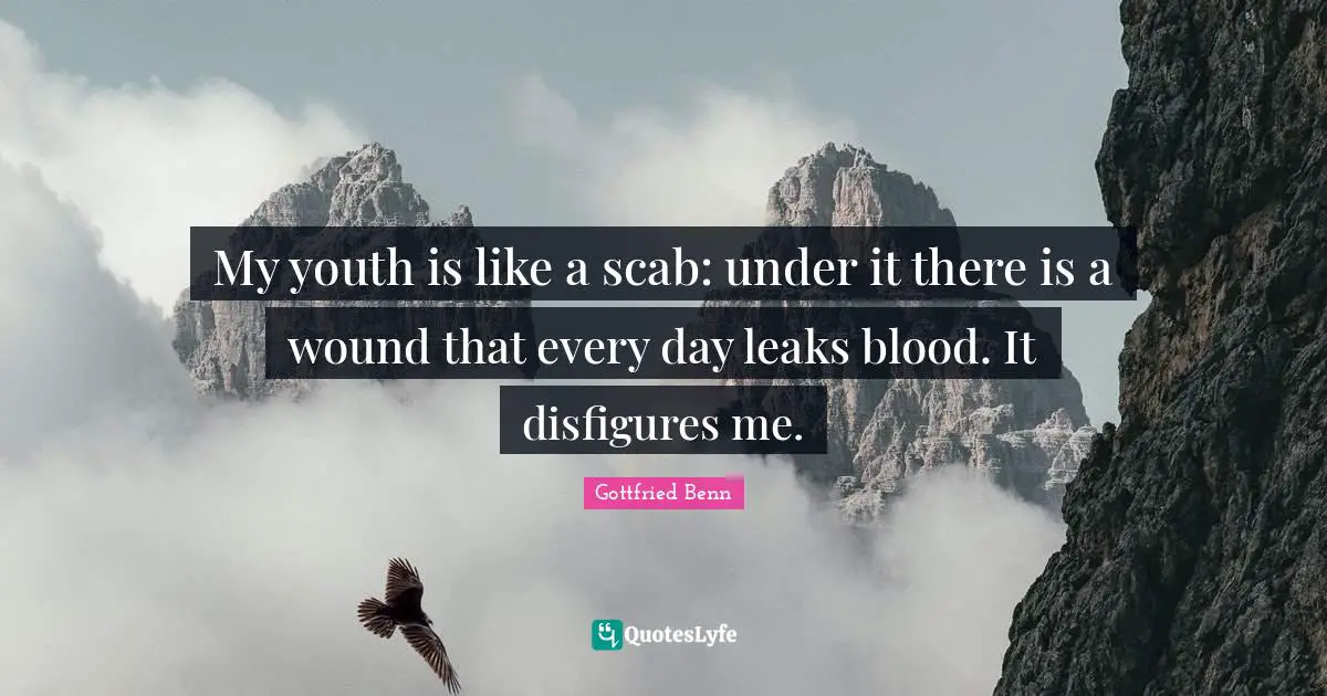 My youth is like a scab: under it there is a wound that every day leaks blood. It disfigures me.
