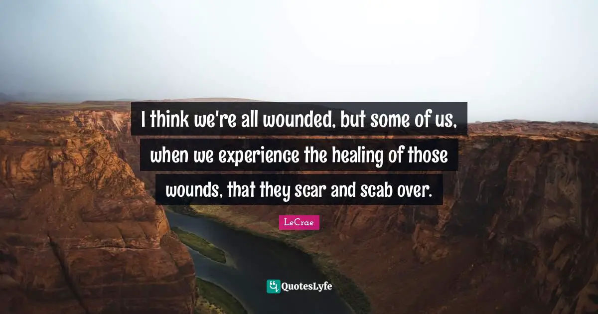 I think we're all wounded, but some of us, when we experience the healing of those wounds, that they scar and scab over.