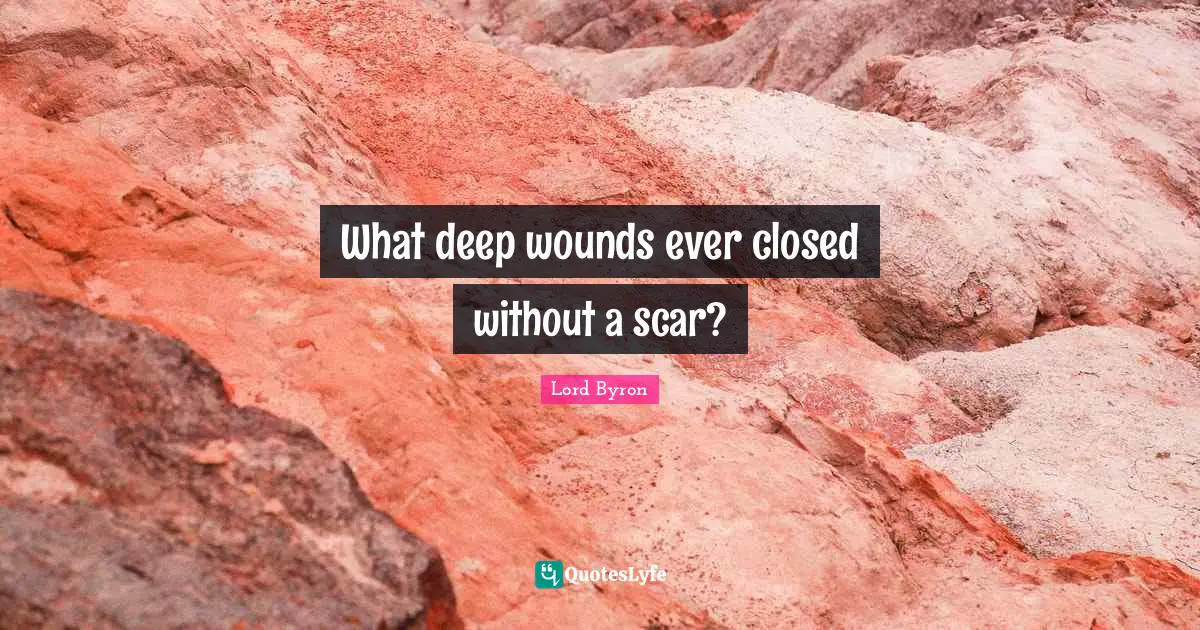 What deep wounds ever closed without a scar?