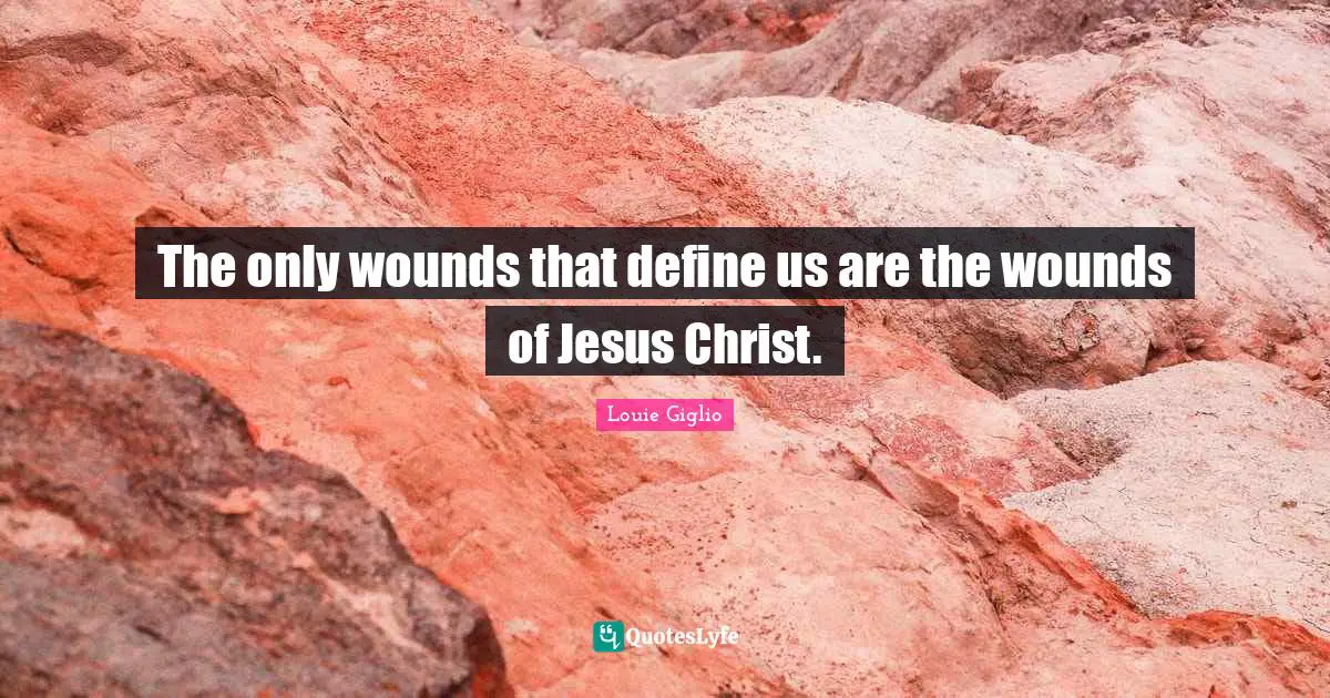 The only wounds that define us are the wounds of Jesus Christ.