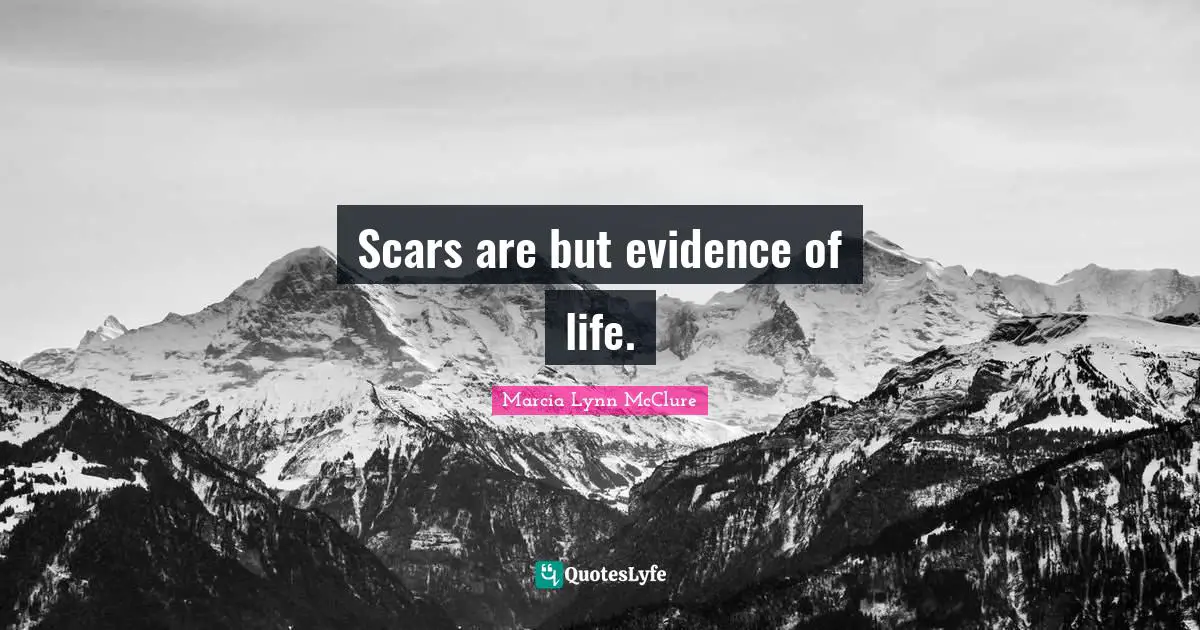 Scars are but evidence of life.