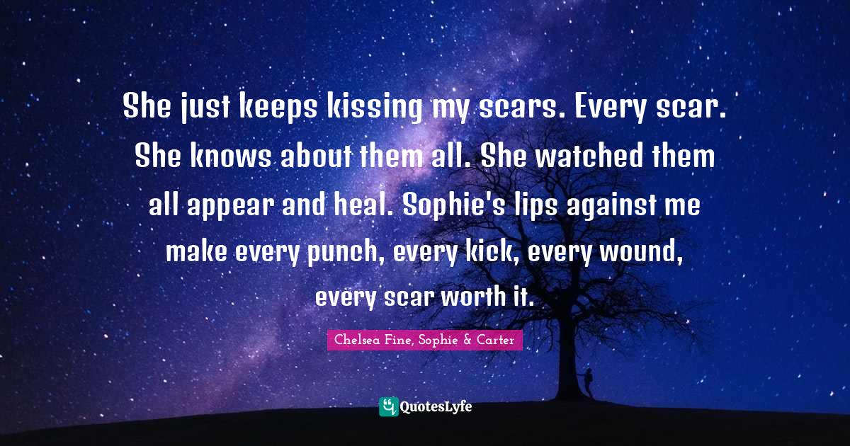 She just keeps kissing my scars. Every scar. She knows about them all