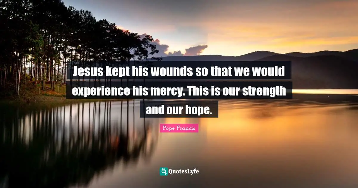 Jesus kept his wounds so that we would experience his mercy. This is our strength and our hope.