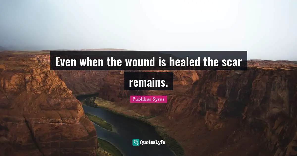 Even when the wound is healed the scar remains.